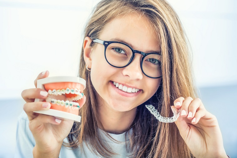 Choosing Between Damon Braces or Invisalign Aligners