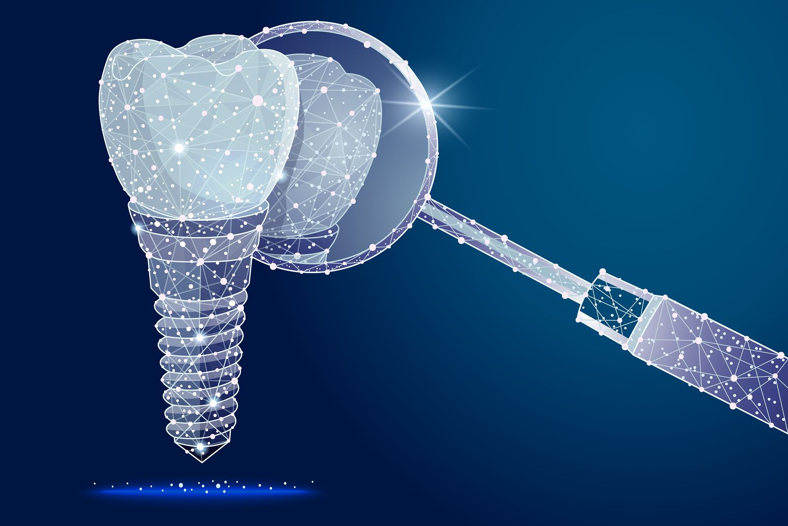 Dental Implants in Chicago Sheffield Square Dental Care