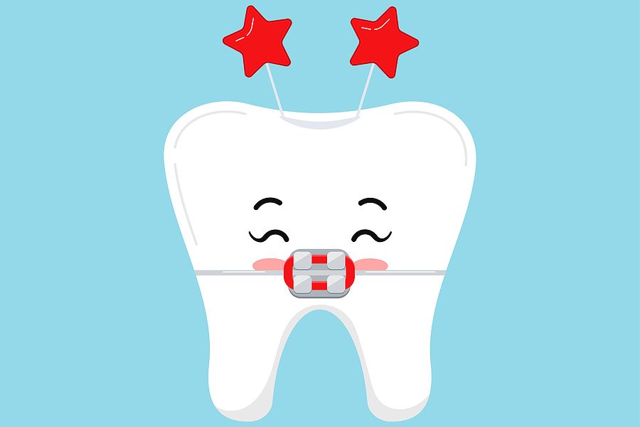 How Long Does It Take To Whiten My Teeth? | Mountain View Advanced Dental  Mountain View