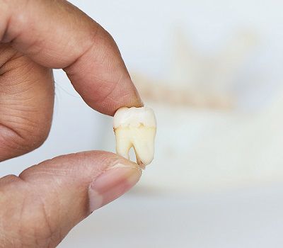 Dentist Yuma Az Foothills : Our Dentists Cater To Children Of All Ages!