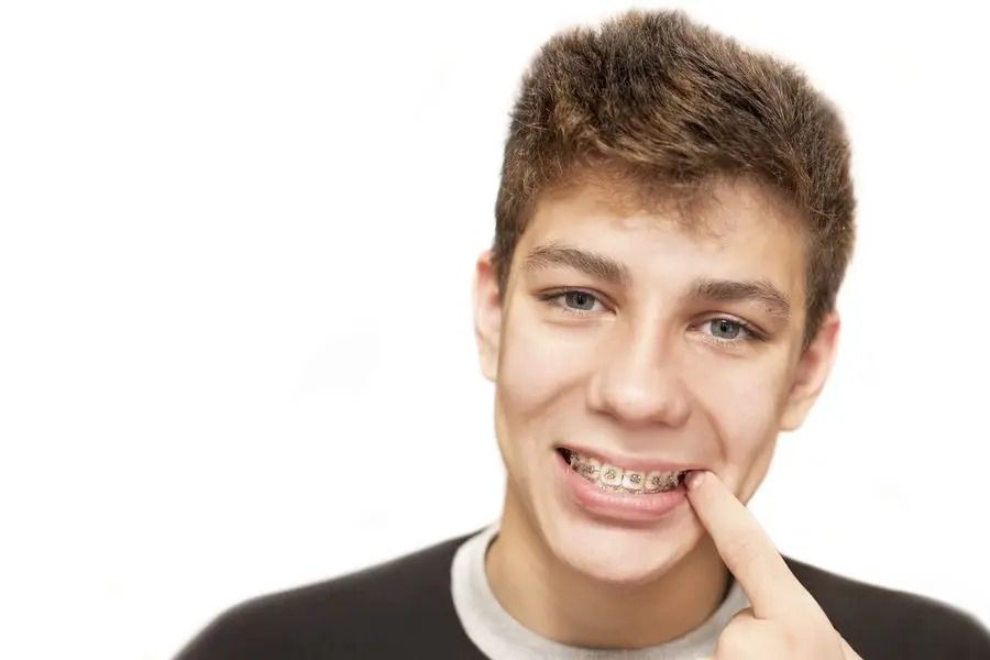 Wearing Braces Can Help Relieve Jaw Pain From a Misaligned Bite