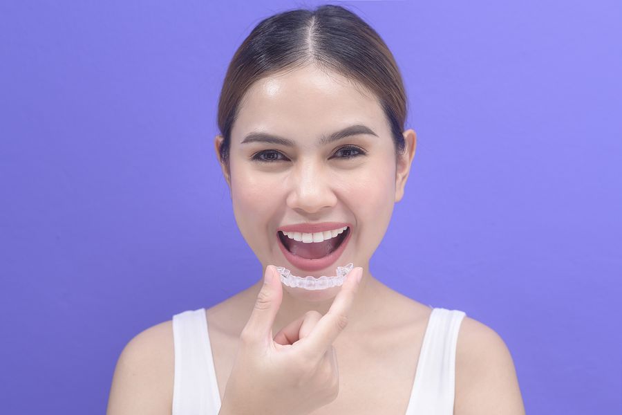 Your Quick Guide to Invisalign