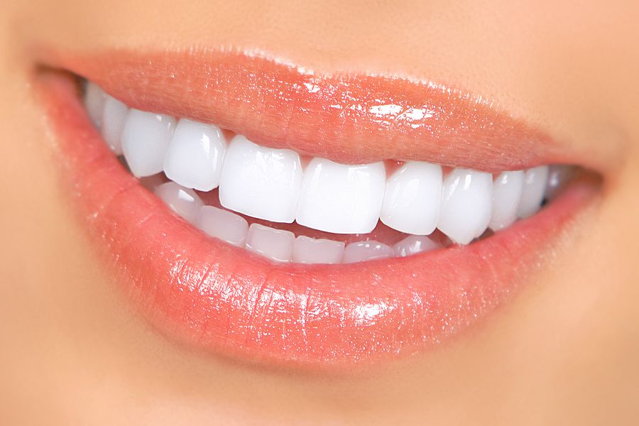Teeth Whitening: Myths & Facts