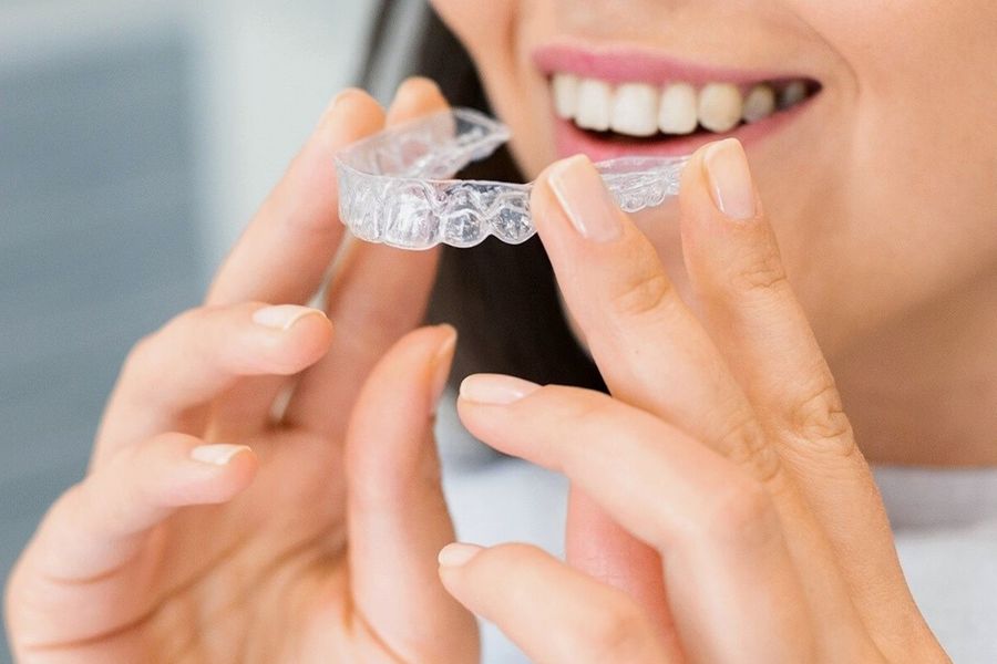 How Are Clear Aligners Different From Traditional Braces? Grace