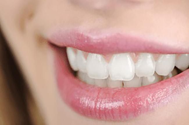 Tooth Whitening
