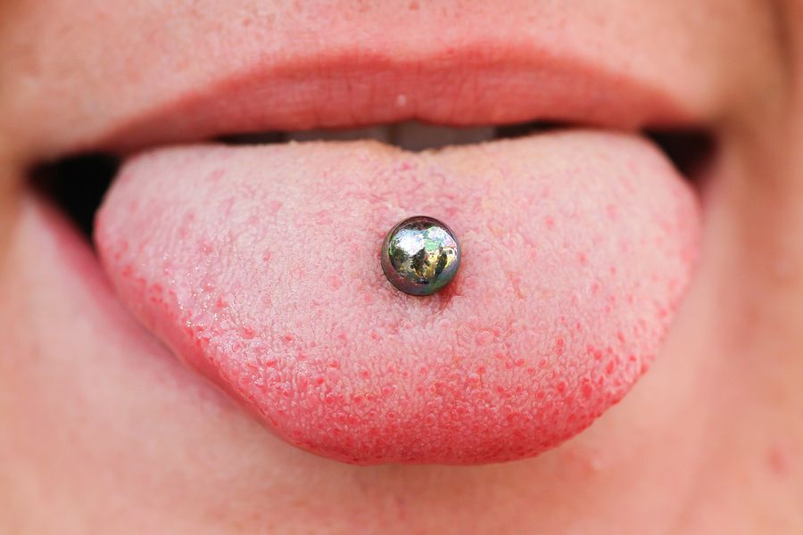 effects-of-tongue-rings-and-tongue-piercings-on-oral-health-point