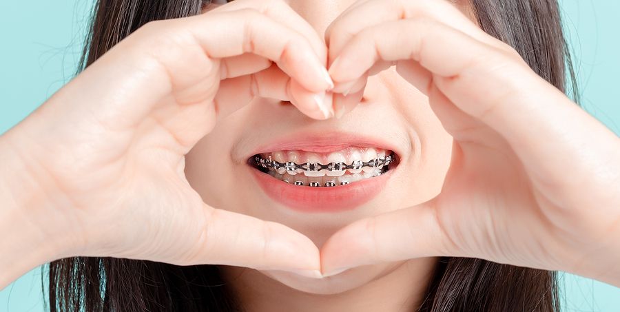 Wearing Braces Can Help Relieve Jaw Pain From A Misaligned Bite ...