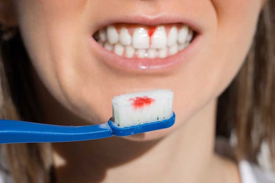 How Gum Disease Affects Your Health Biltmore Commons Dental Care