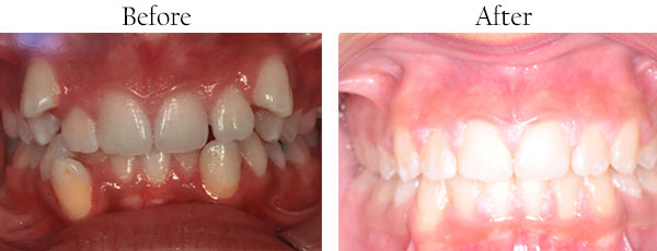 Dentist in Whittier