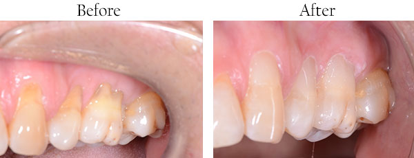 West Whittier Dentist