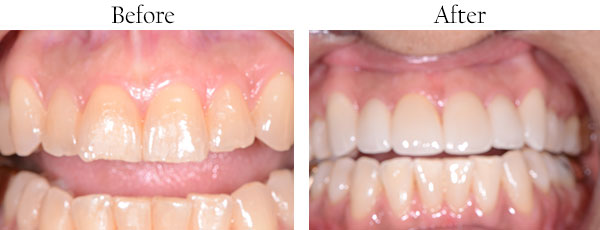 Dentist in West Whittier