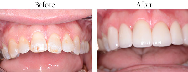 Dentist in Hacienda Heights