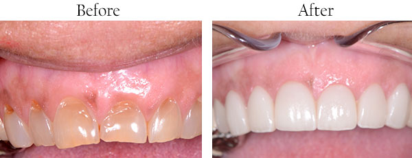 Whittier Dentist