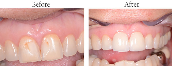 Hacienda Heights Dentist