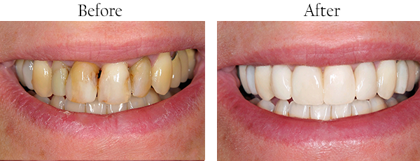 Dentist Whittier