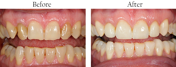 Dentist West Whittier