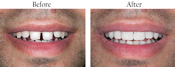 Dentist Hacienda Heights
