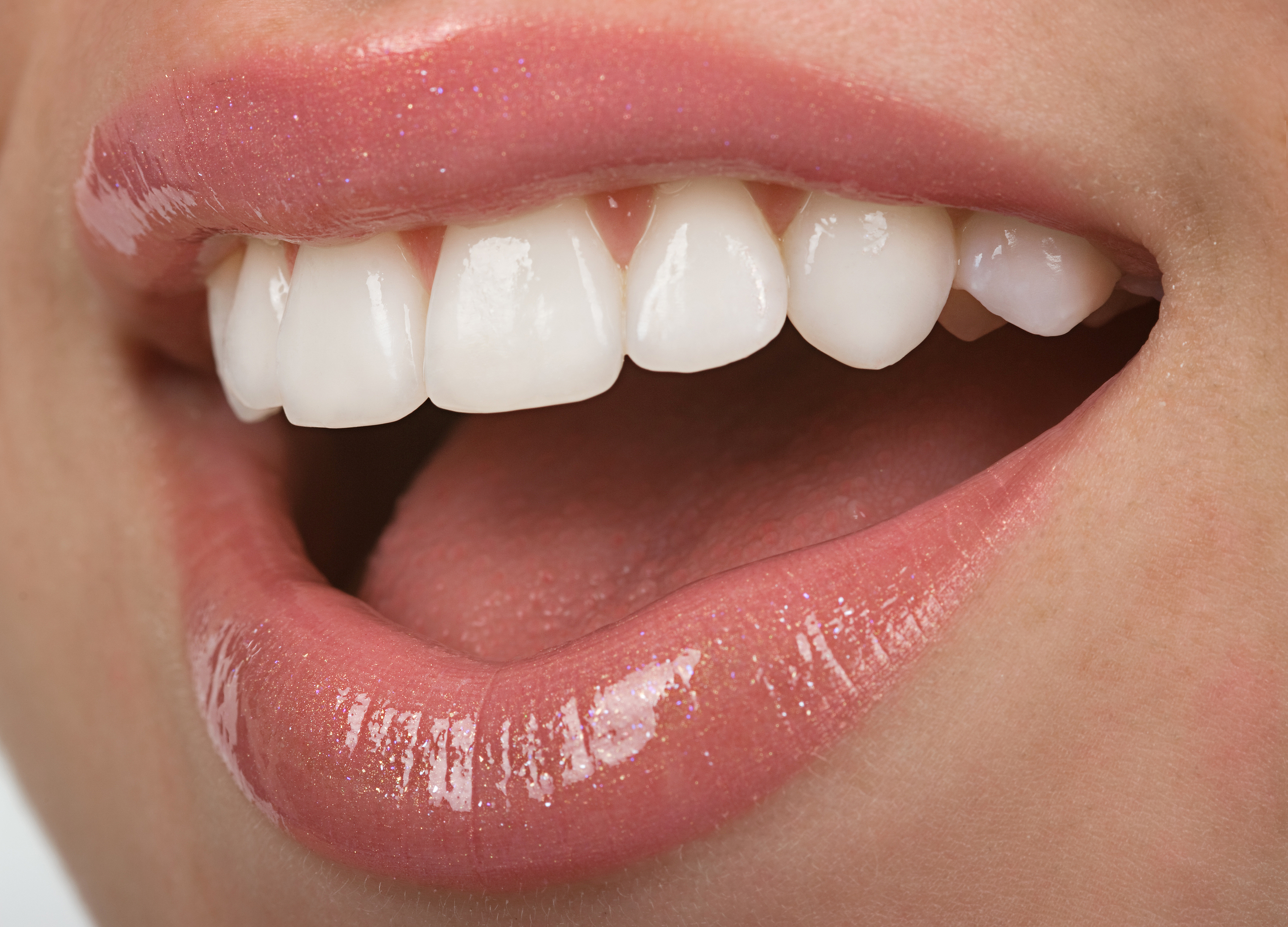 Dental Veneers in Miami Florida Dental Veneers in Pembroke Pines FL