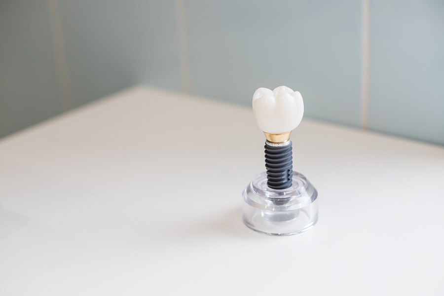 Discover the Benefits of Dental Implants Picacho Family Dental