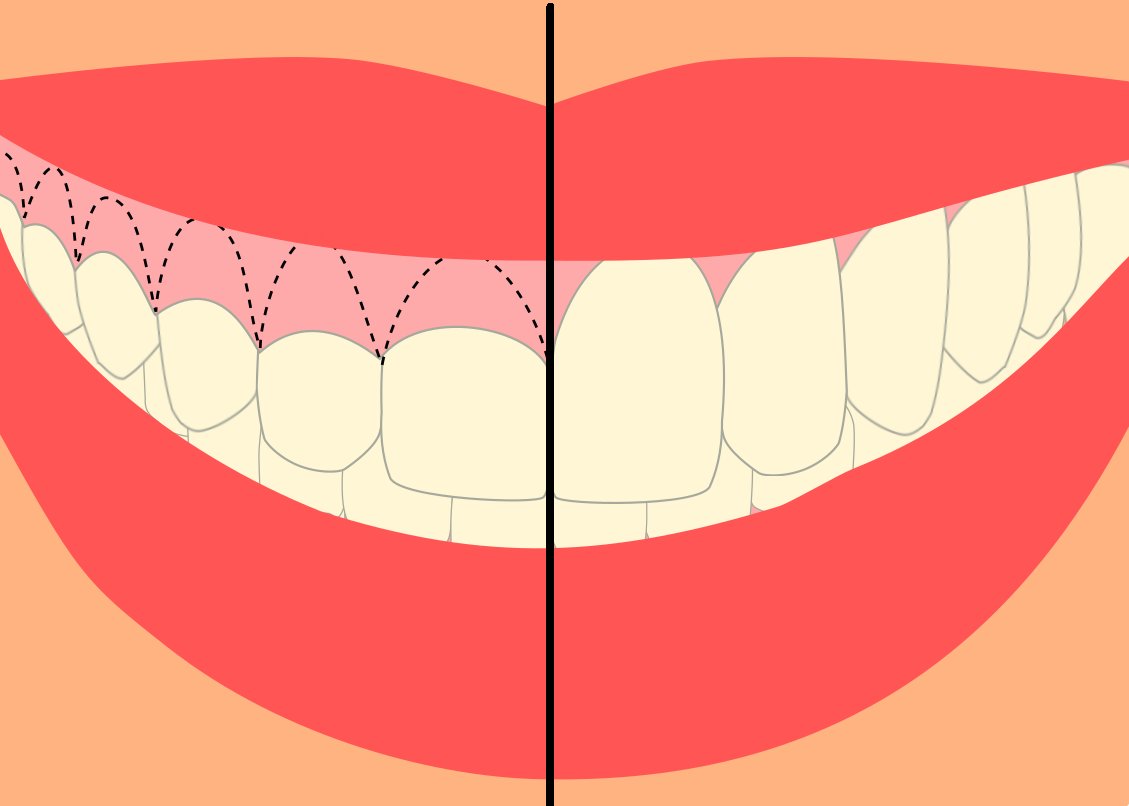 Sabe cuál es el cepillo dental correcto para usted?Dental Clinic – Dentists  in Tijuana