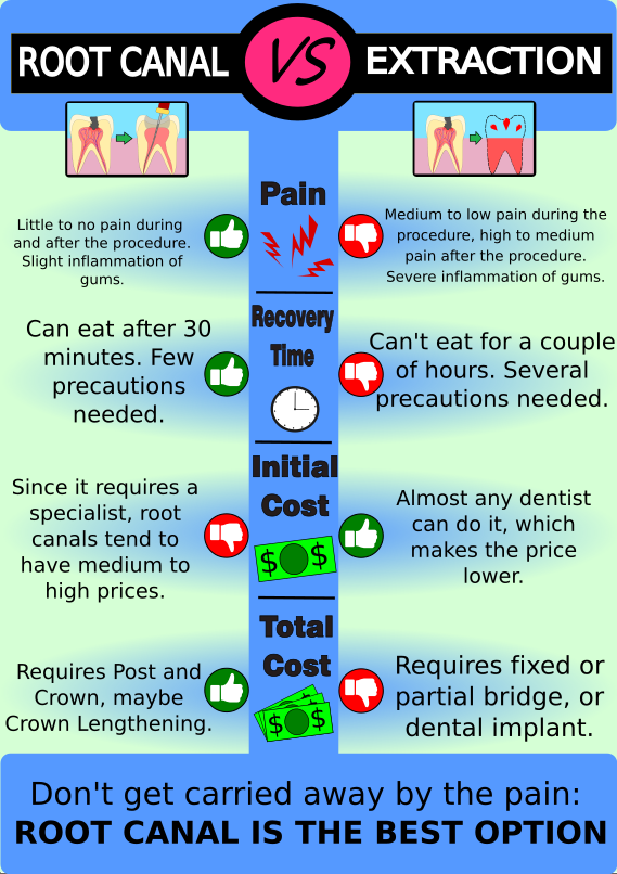 Root Canal Vs Extraction Pros And Cons General Family And Cosmetic Dentist Tijuana Baja California Mexico