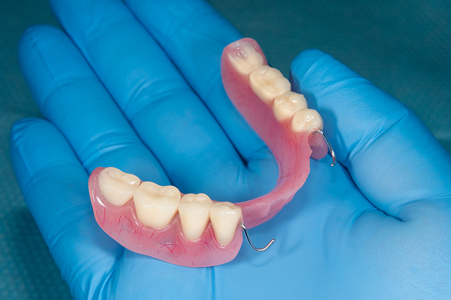 partials-in-southaven-ms-desoto-dentures-and-implants-partials-in