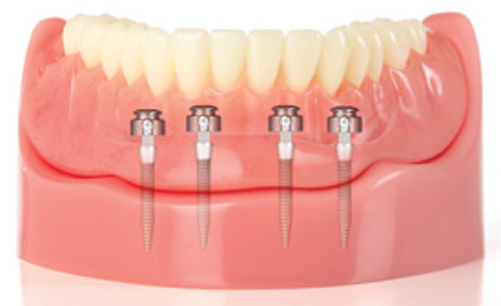 Image related to a dental practice located in Providence, RI called Peter A Payne DMD Implant Dentistry and Periodontics