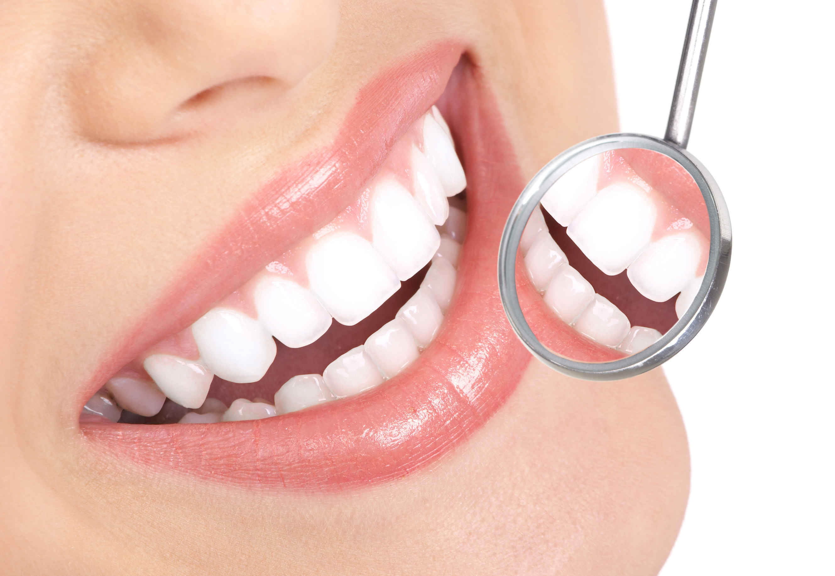 5 things to know about Teeth Whitening