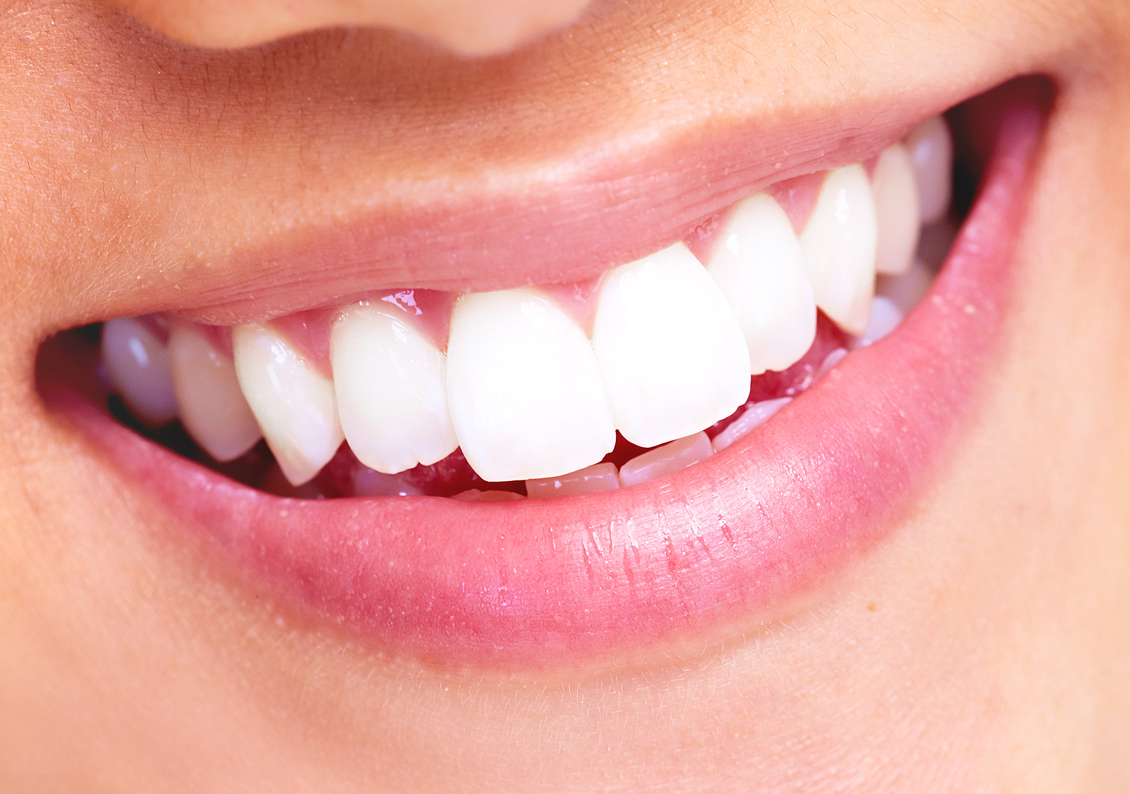 Heathy Smile Of Birmingham Image 