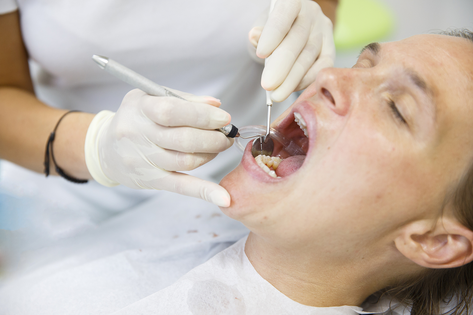 The Benefits of Root Canal Treatment: Why Saving Your Tooth is Worth It |  Fay Hu DMD Winter Park, FL