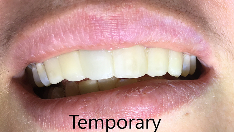 Happy Patients Desoto Dentures And Implants Southaven Ms 