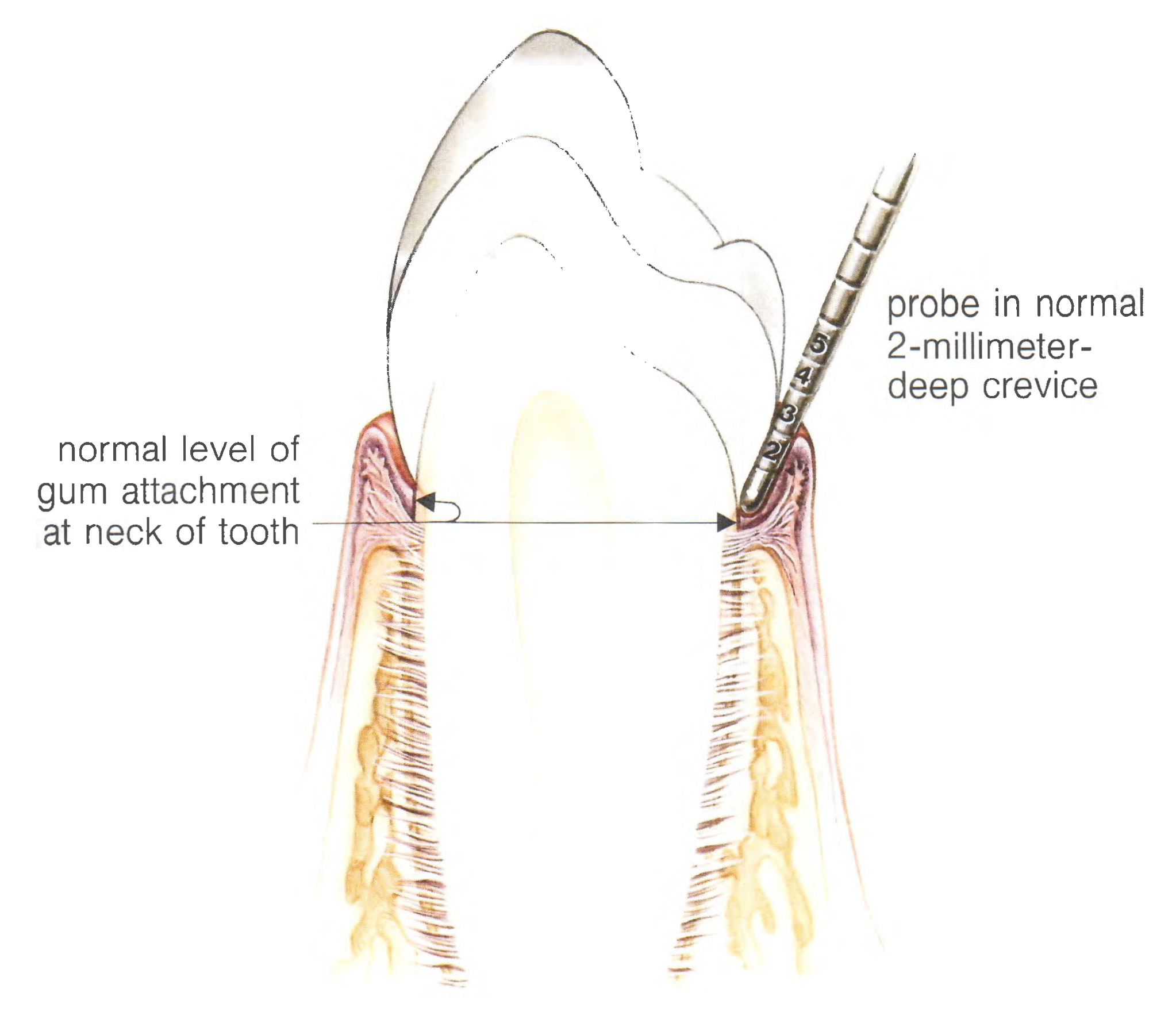 comprehensive-periodontal-evaluation-cpe-providence-ri-peter-a