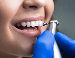 Teeth Cleaning (Existing patients)