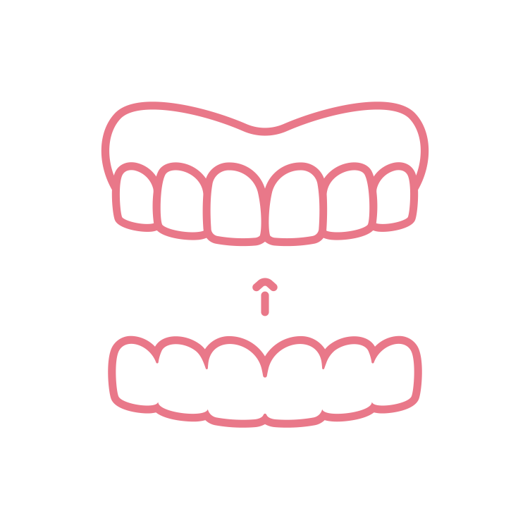 Invisalign