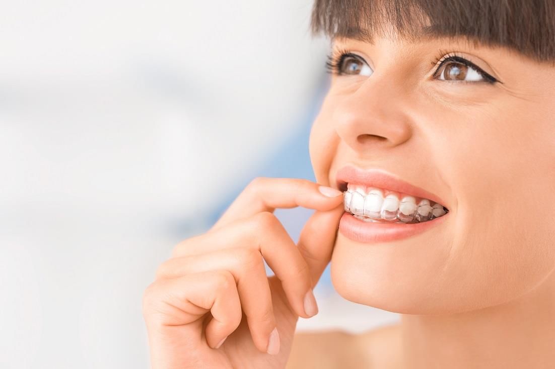 Who is the Ideal Candidate for Invisalign?
