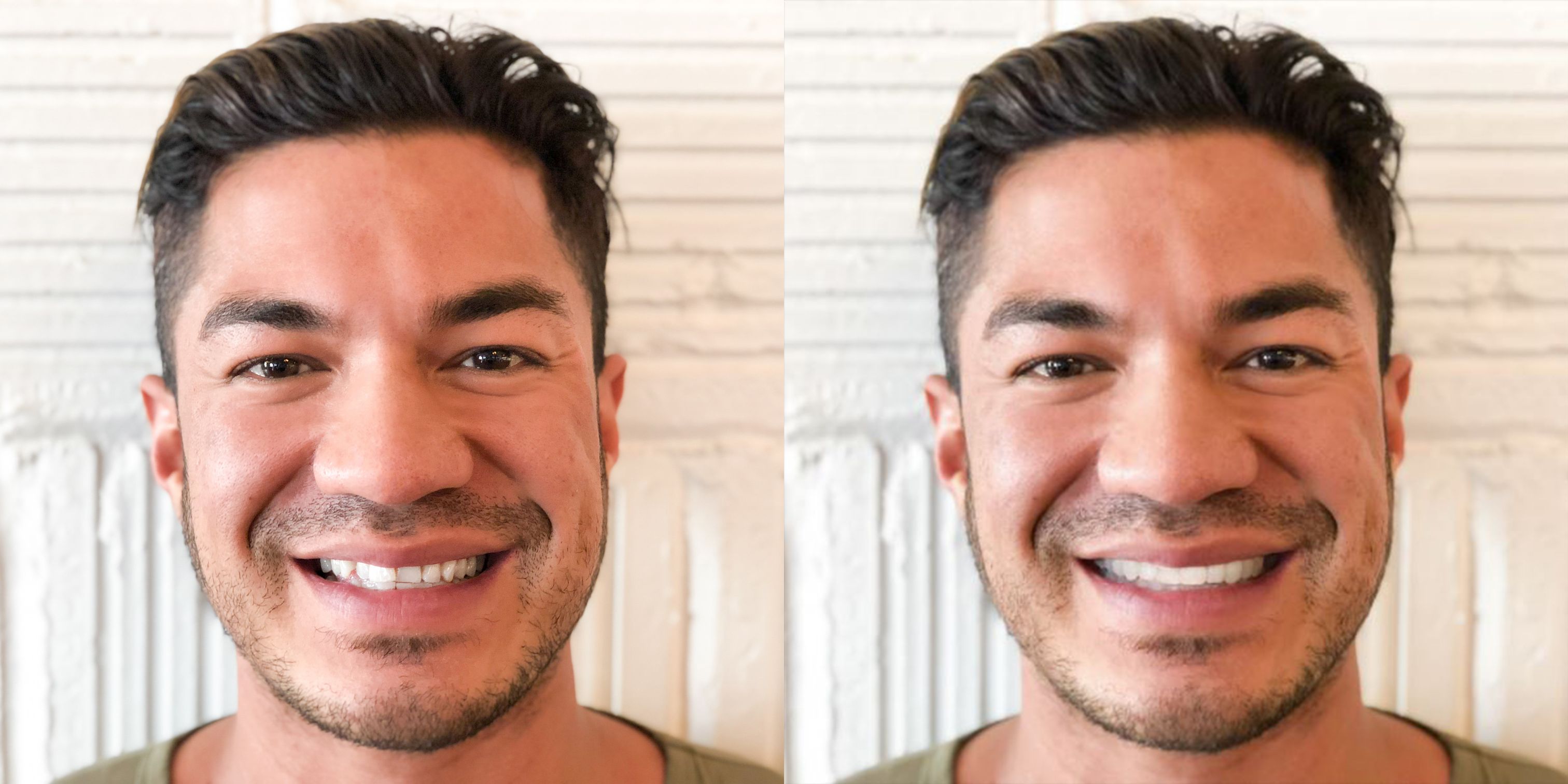 smile gallery