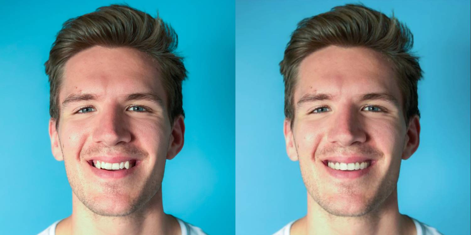 smile gallery