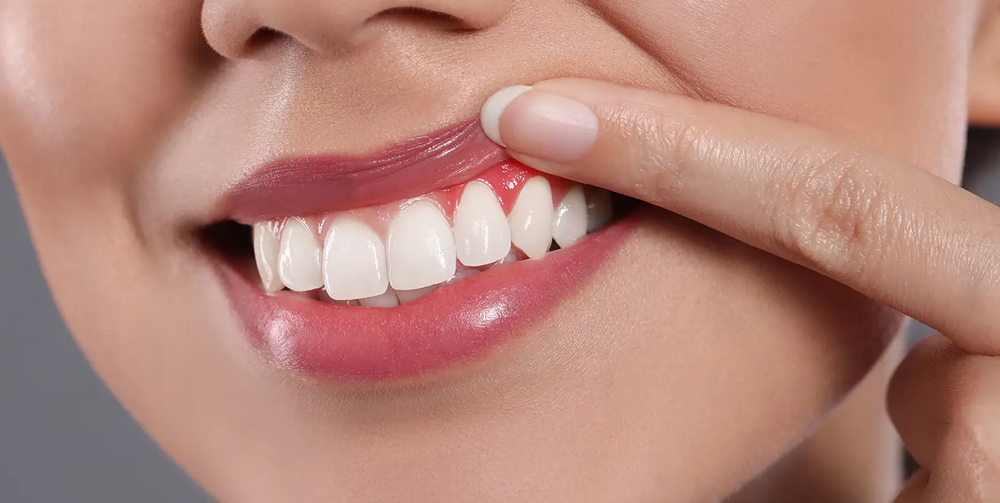 Gum Disease in Mountain View, CA Growing Smiles Pediatric Dentistry