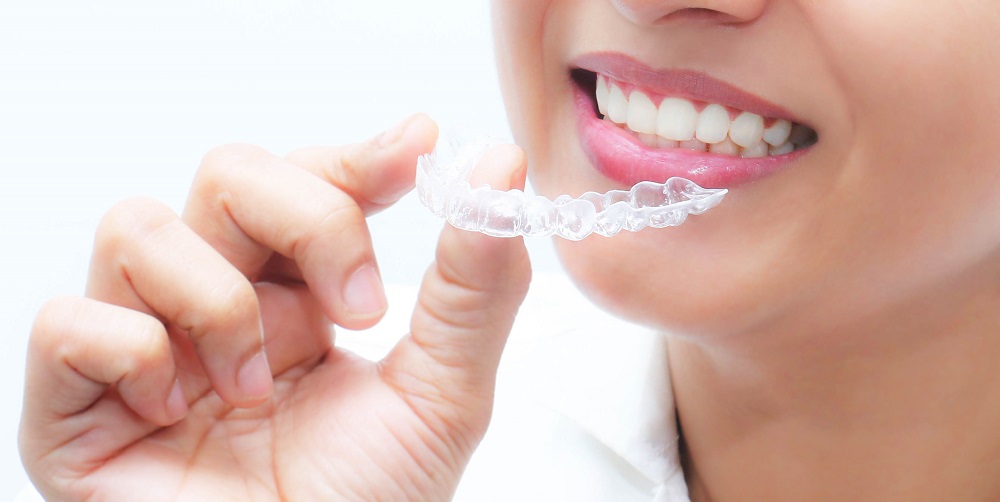 Clear Aligners Blaine, MN