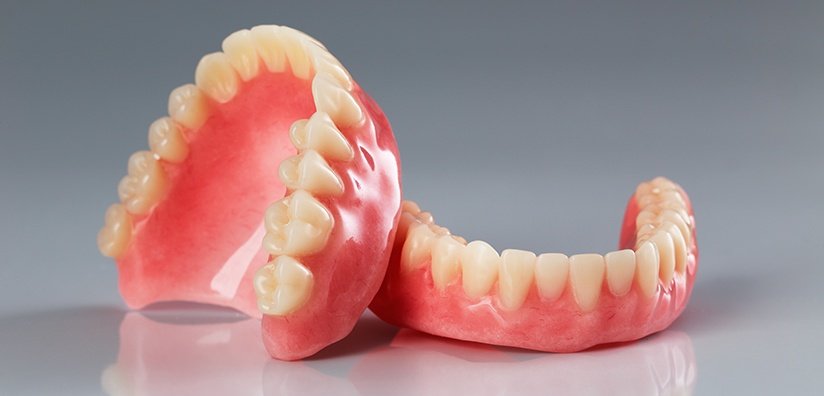 implant supported dentures