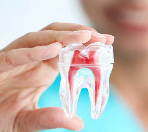 Root Canals Root Canals
