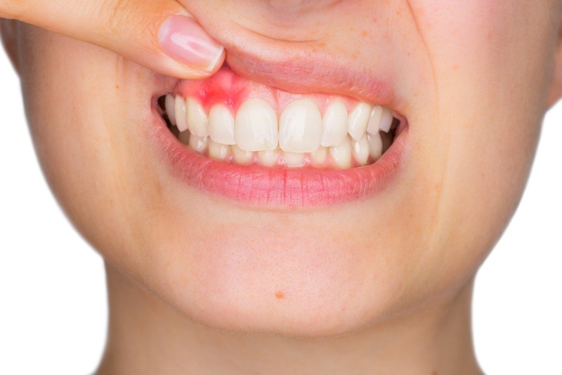 Gum Disease Treatment Gum Disease Treatment