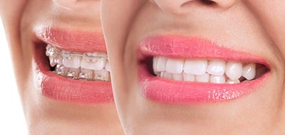 smile-img