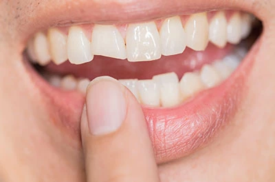 smile-img