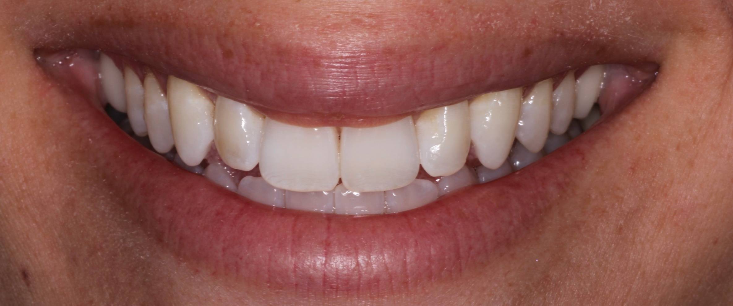 Meet Dr. Fulton Fulton Dental Vestavia Hills, AL