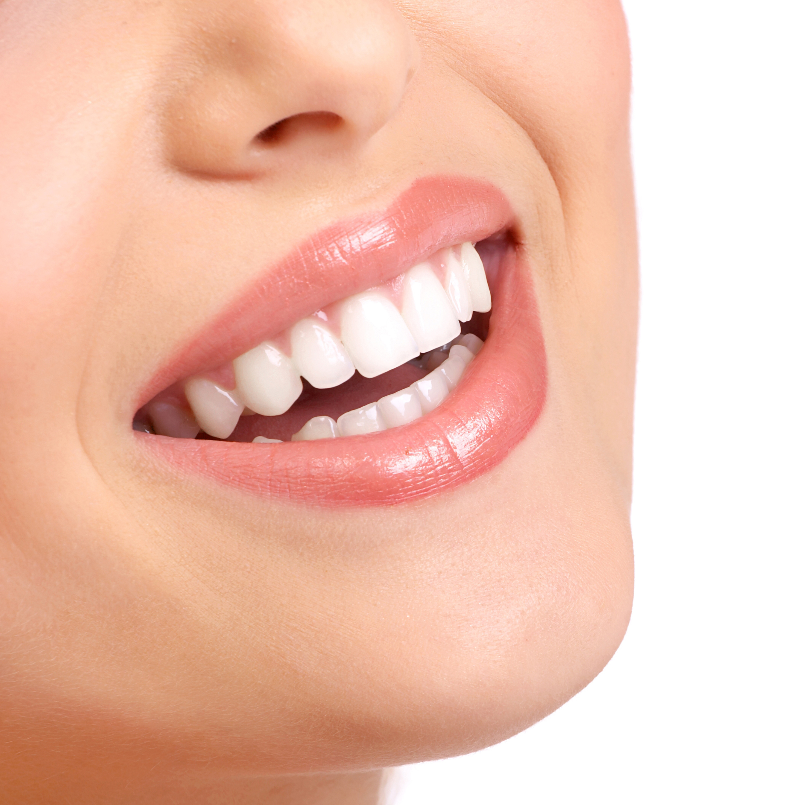 Отбеливание зубов в стоматологии