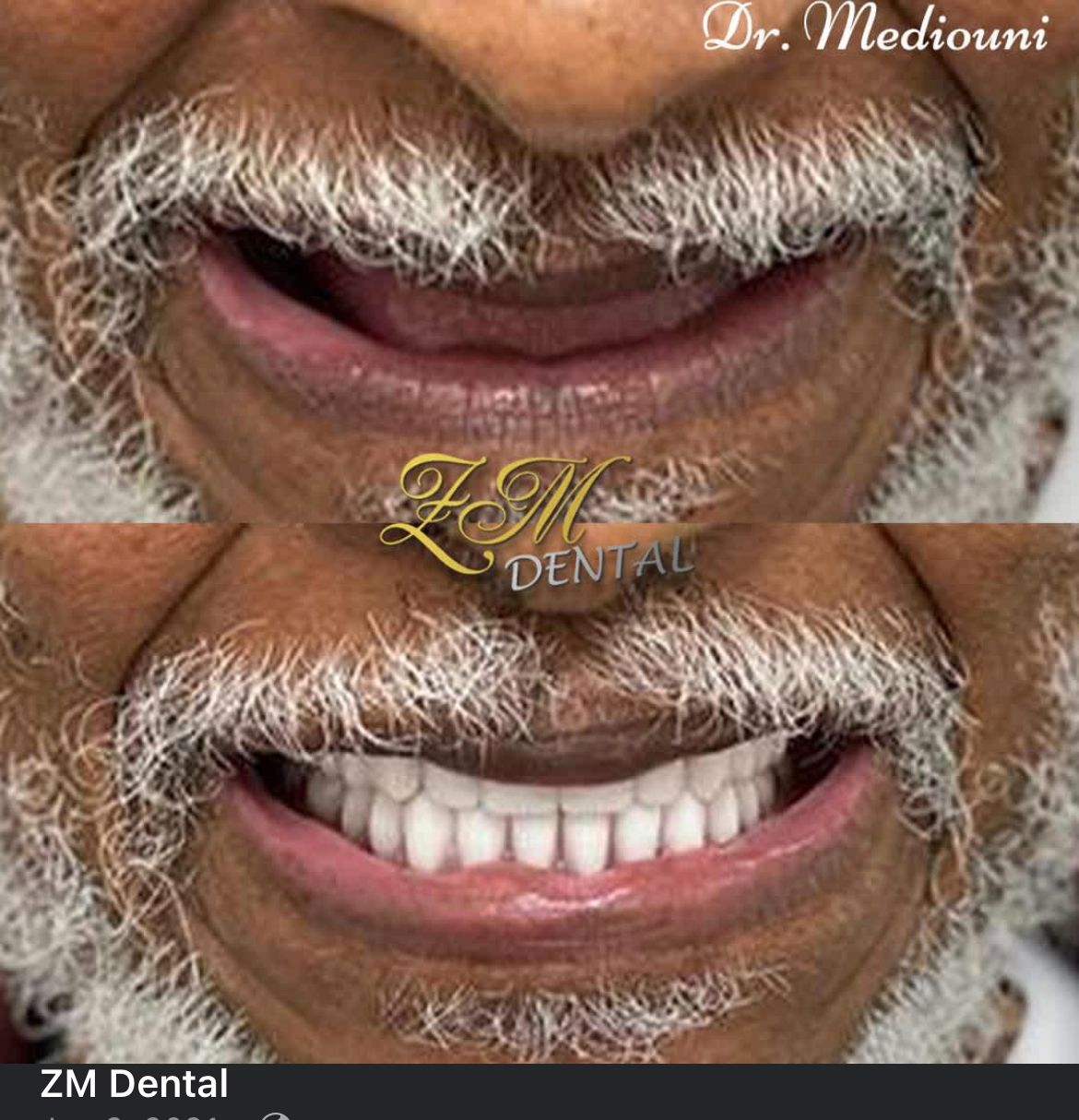 Smile Image