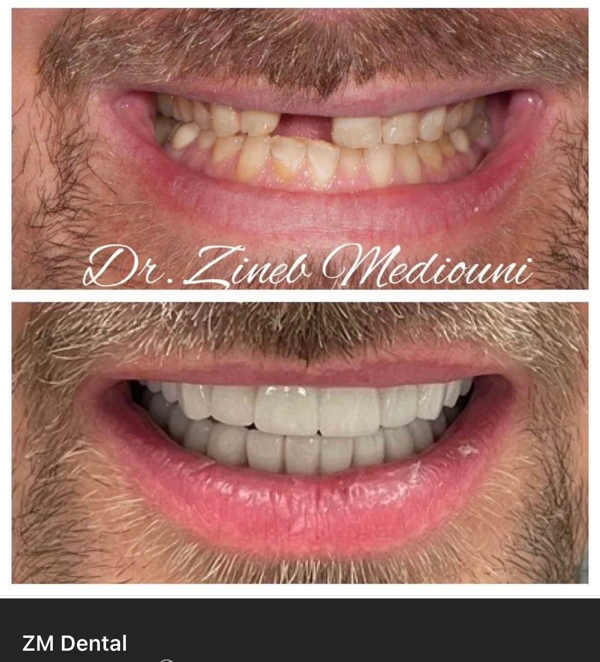 Smile Image
