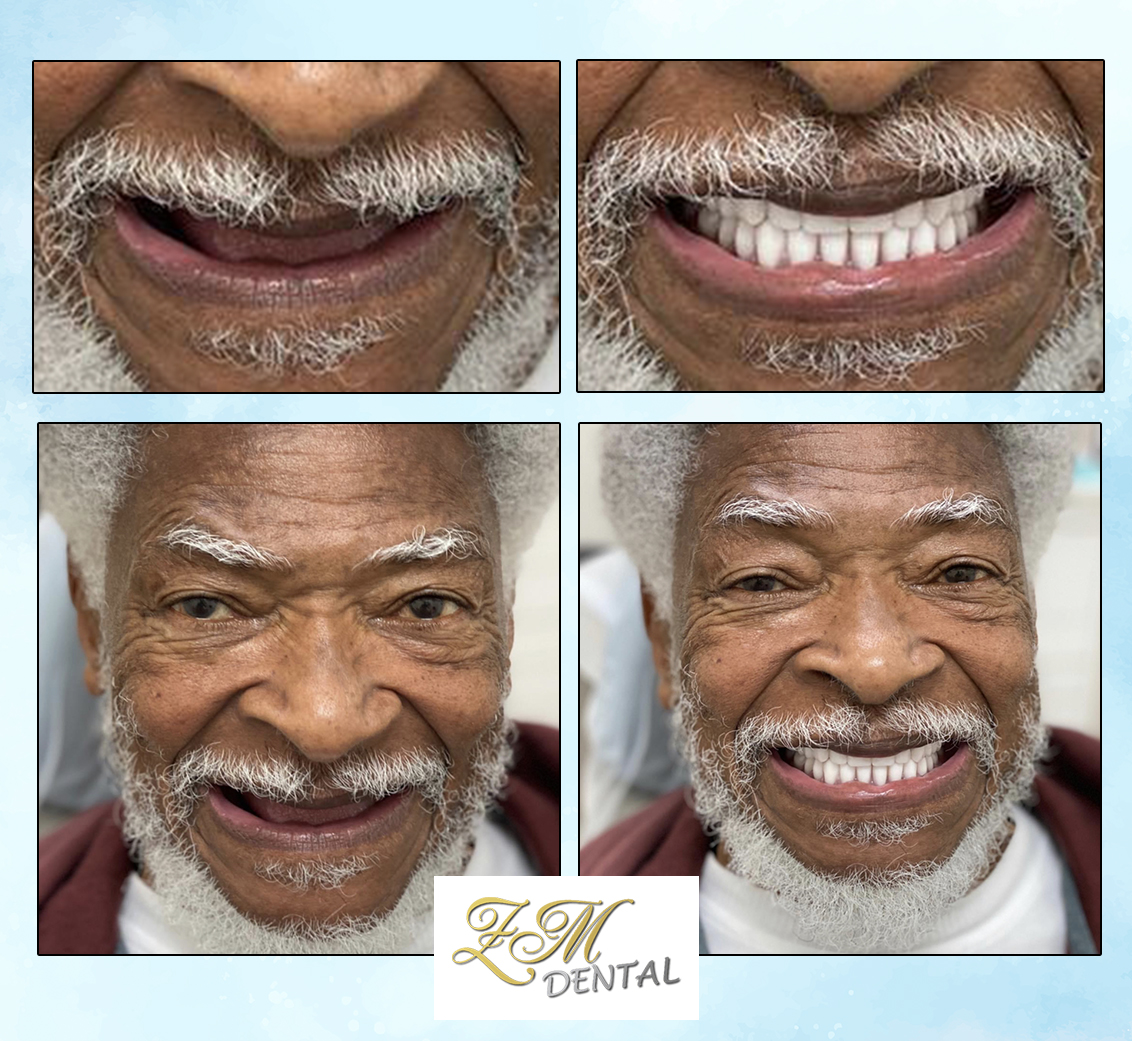 Smile Image
