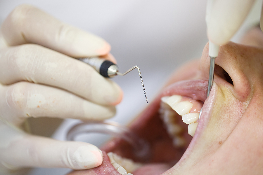 Understanding Periodontal Disease: Causes, Symptoms, and Treatment